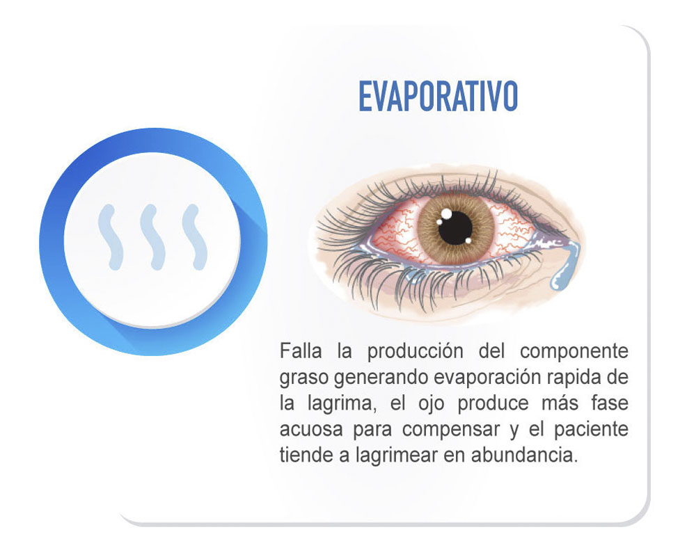 ojo seco evaporativo